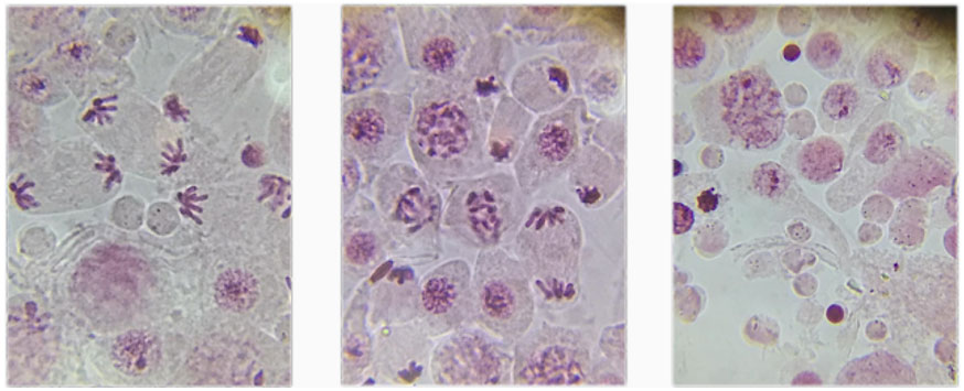 Sinh 10 Bài 18: Thực hành làm và quan sát tiêu bản quá trình nguyên phân và giảm phân | Giải Sinh học 10 Kết nối tri thức (ảnh 1)